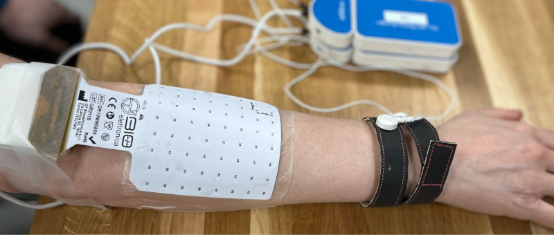 photo of an EMG electrode grid on a subject's forearm photo of EMG electrodes